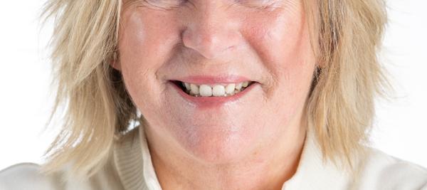 Karin Verbiest